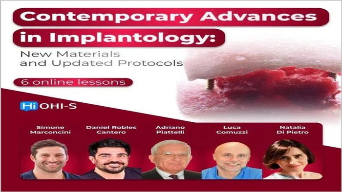Contemporary Advances in Implantology New Materials and Updated Protocols