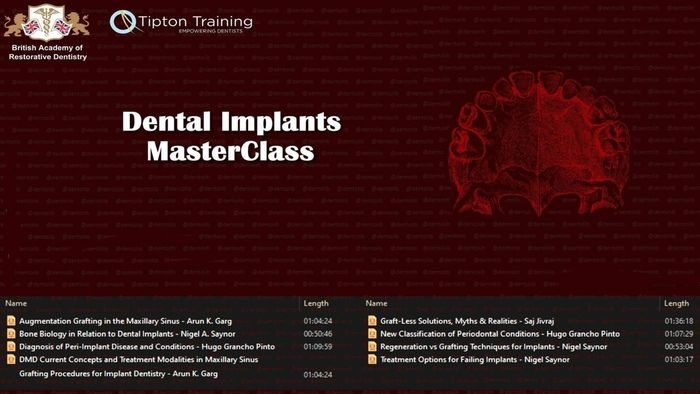 Dental Implant Masterclass